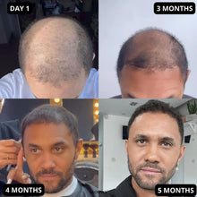 Load image into Gallery viewer, Glowwa Hair Food